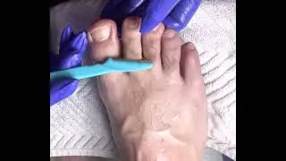 Manscaping Hairy Feet (Must Watch) (Left Foot)