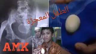 برنامج حكايتى | الطفل المعجزة 😲 شاب يبيض مثل الدجاج