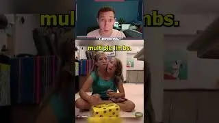 Do Conjoined Twins Deserve 1 Salary Or 2?