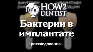 Как бактерия проникает в имплантат / How to Dentist