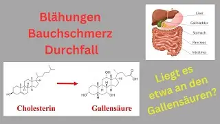 Blähungen Bauchschmerz, Durchfall - liegt es etwa an den Gallensäuren?
