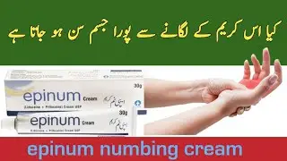Lidocaine prilocaine cream | Lidocaine and prilocaine cream uses | epinum cream |epinum cream review