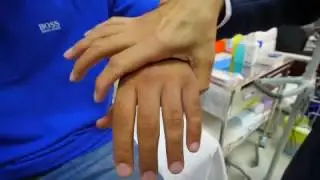 Squeeze test for MCP joints