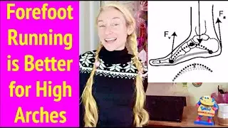 Can You Run with High Arch Feet? Yes, Just Don't Heel Strike!