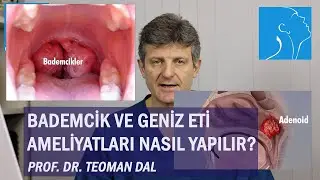 BADEMCİK VE GENİZ ETİ AMELİYATLARI NASIL YAPILIR | PROF. DR. TEOMAN DAL