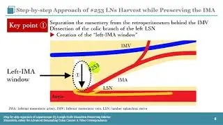 Step-by-step Approach of Lap D3 Lymph Node Dissection for Advanced Descending Colon Cancer: