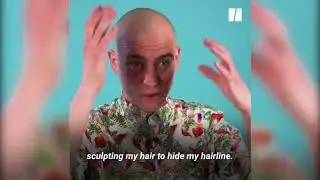 Dealing With Going Bald Young