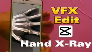Hand X-Ray Edit Using CAPCUT App | Vfx Edit | Video Edit Tutorial
