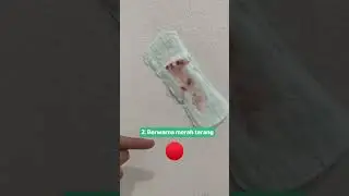 Flek Karena Hamil Kayak Gimana Sih?