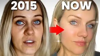 REACTING TO MY FIRST EVER VIDEO 8 YEARS AGO - I look younger now without botox !