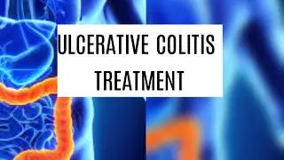 Ulcerative colitis treatment