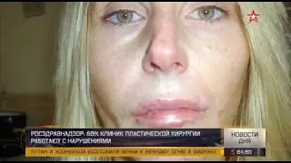 Burned eyes after beauty injections. Be careful, cosmetologist!