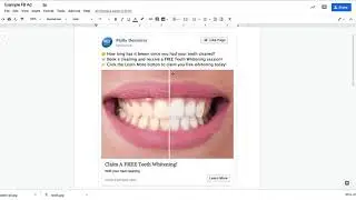 Software Automation of a Claim/Booking Campaign for a Dentist