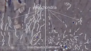 Denaturation of mitochondria by iron chelating agent ー 鉄キレート剤によるミトコンドリアの変性 ー