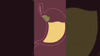 Why your farts stink and mine don't 🤔💨 