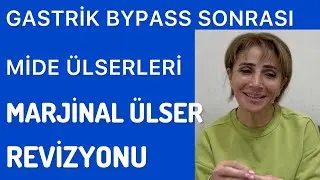 GASTRİK BYPASS AMELİYATININ, GELİŞEN MARJİNAL ÜLSERLER NEDENİYLE İLEAL İNTERPOZYONA REVİZYONU