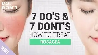 14 Tips for Rosacea That Really Work | Effective Skin Care Tips for Rosacea | Do & Don't