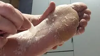 Bea's UP Foot Peel from Japan REVIEW