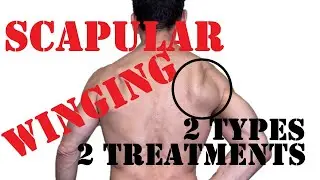 How to Fix Scapular Winging (and Why it Happens)