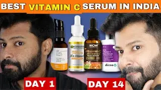 Must Watch before Buying Vitamin C Serum for Skin Brightening | Shocking Results 😱😍 | Shadhik Azeez