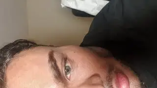 Reversal of Keratopigmentation Eye Color Change Surgery Pre-Op  Brightocular