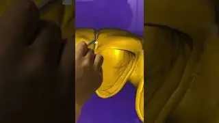 Designing an Anterior Bridge 