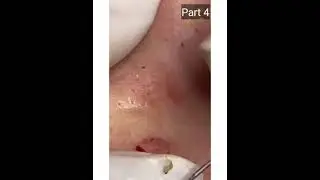 INGAT!! INI BARU YANG DINAMAKAN KOMEDO!!! Part 4