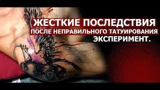 ЖЕСТКИЕ ПОСЛЕДСТВИЯ ПОСЛЕ НЕПРАВИЛЬНОГО ТАТУИРОВАНИЯ. ЭКСПЕРИМЕНТ.