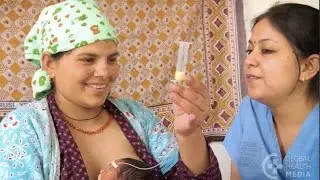 Feeding with a Nasogastric Tube - Small Baby Series