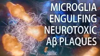 Microglial engulfment of Aβ plaques | Alzheimer’s disease | medical animation
