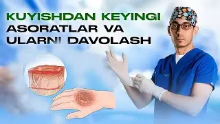 Kuyishdan keyingi asoratlar va ularning davolash usullari
