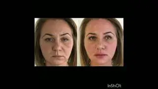 Услуги центра ,массаж,Гирудотерапия