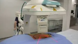 Ziehm Vision RFD 3D C-arm with Stryker’s SpineMap® 3D Software