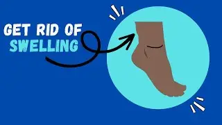 How to Fix Swollen Legs and Feet