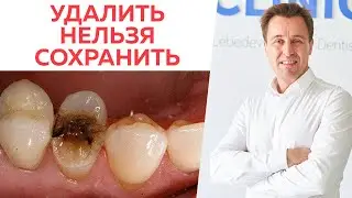 To remove a tooth or to leave it? \ How does a doctor decide when to remove a tooth and when to l...
