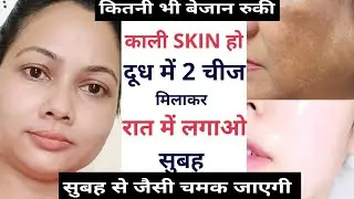 Best Homemade Mask for Tan Removing | Skin Whitening Face Pack | Best Remedy |