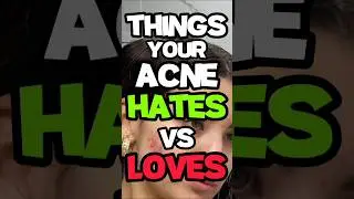Things Your Acne Hates vs Loves | Tips for Acne #shorts #acnetreatment #acne #glowuptips