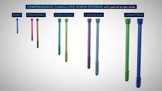 CAPTIVATE™ SOLA Headless Compression Screw System Technique Animation