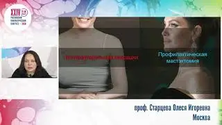 Профилактическая мастэктомия. Взгляд пластического хирурга