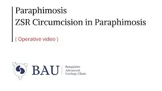 Paraphimosis / ZSR Circumcision for Paraphimosis