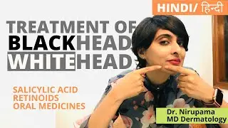 Blackhead whitehead removal| Blackhead treatment| Whitehead treatment| Blackhead whitehead treatment