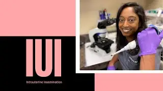 Intrauterine insemination (IUI)