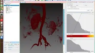 Simvascular Tutorial 1: Loading and Manipulating Image Data