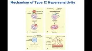Chapter 16 Disorders of the Immune Response BIO216