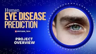 Human Eye Disease Detection System Introduction | Image Classification Project | Overview of Project