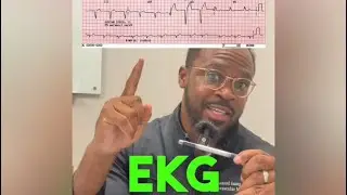 Heart Doctor Explains Left Bundle Branch Block