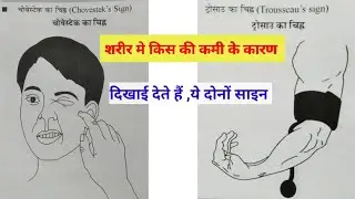 chvostek sign and trousseau sign  || medical surgical nursing