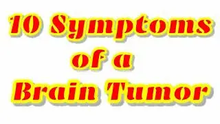 10 Symptoms of a Brain Tumor