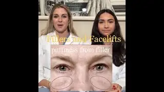 Fillers and Facelifts with Sam & Meg