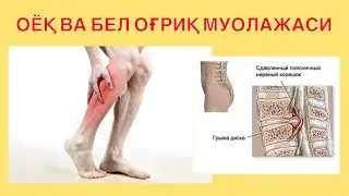 Оёқ бел оғриқ муолажаси. Асл кинезиология #artroz #grija #грижа #akromkineziolog #акромкинезиолог
